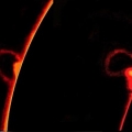 Coronal flair